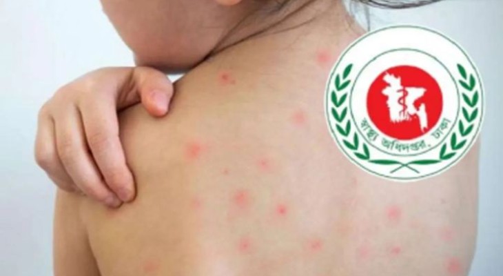 হামে আরও ৫ জনের মৃত্যু, নতুন আক্রান্ত ১৪৯৪ জন